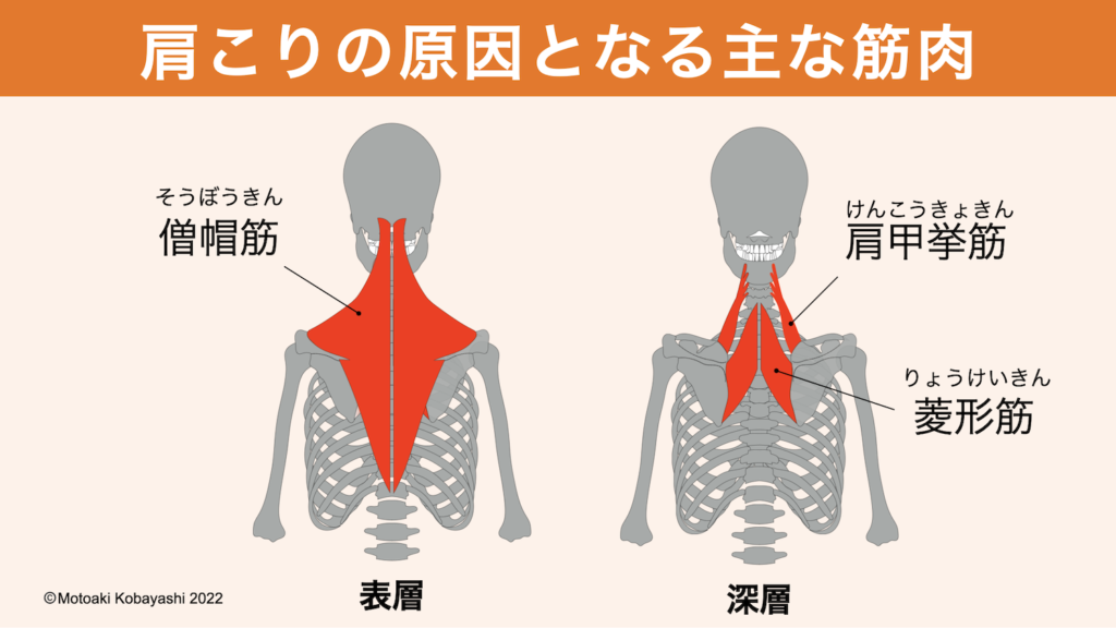 肩こりの原因となる筋肉　僧帽筋、肩甲挙筋、菱形筋